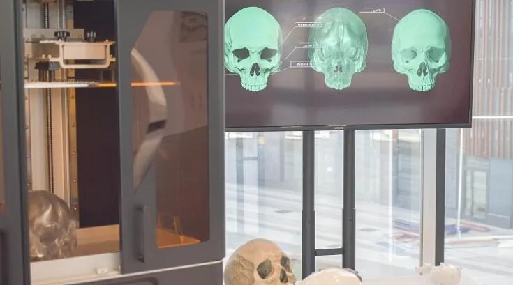 3D-печать анатомически точных копий человеческих органов на 3D-принтере Phrozen Sonic Mega 8K