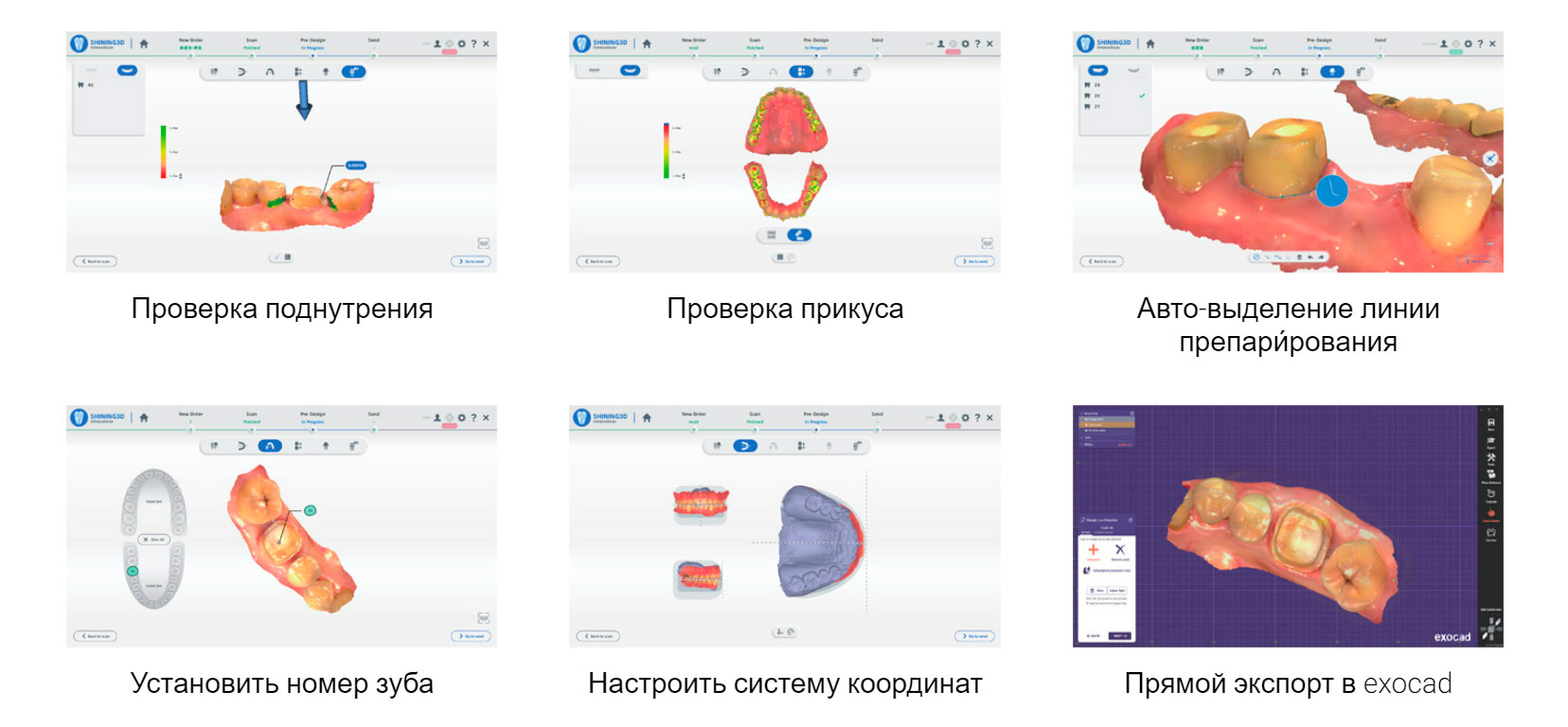 Shining3DAoralscan3-6.jpg Shining3DAoralscan3-6.jpg